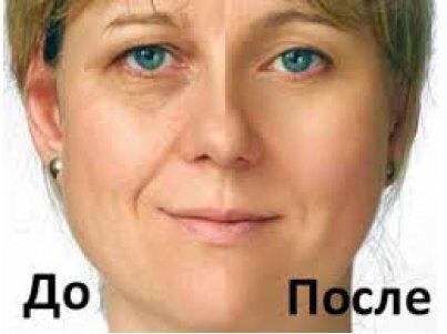 Коллагенарий (омоложение кожи)