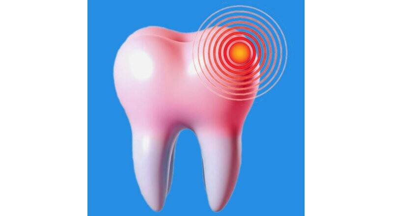 Оказание помощи при острой зубной боли