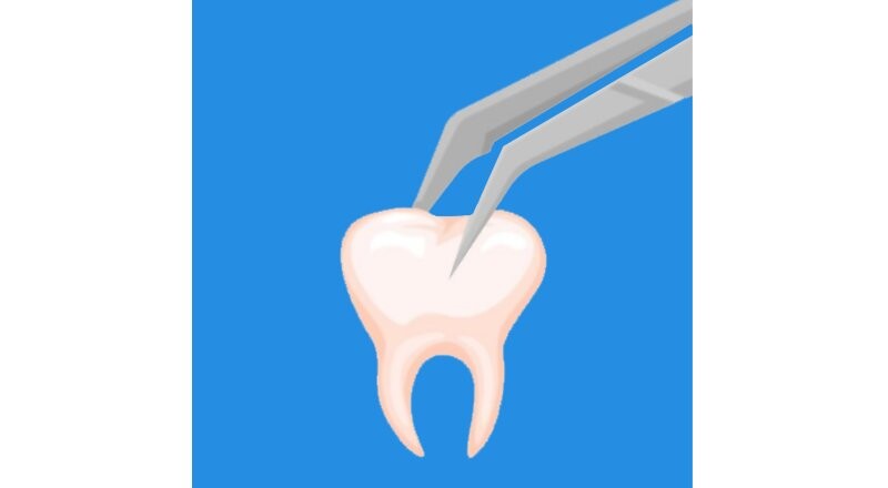 Удаление зуба