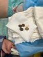 В Прокопьевске врачи спасли мальчика, проглотившего четыре монеты